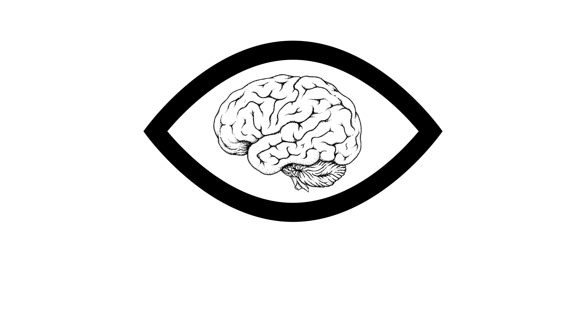 MIndsight Metal logo