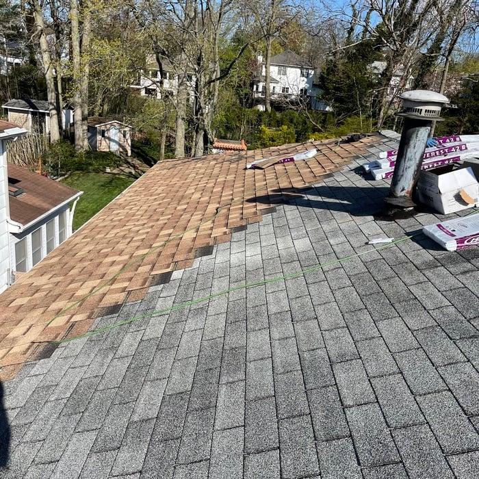 Shingles