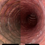 Air Duct Cleaning
