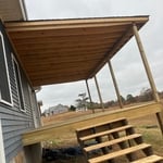Side view