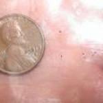 Bird Mite on a Penny