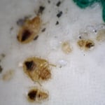 Bed bugs