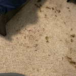 Human feces of person confined to wheelchair