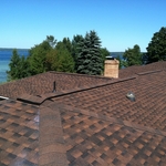 Shingles