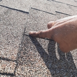 Before- Exposed Nail