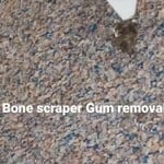 Gum removal