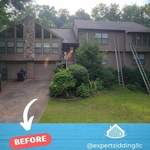Before - Front