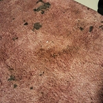 Carpet cleaning