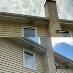 Fascia Repair