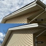Fascia Repair