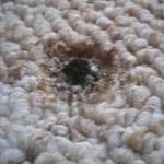 Burn hole repair