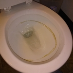 Toilet cleaning