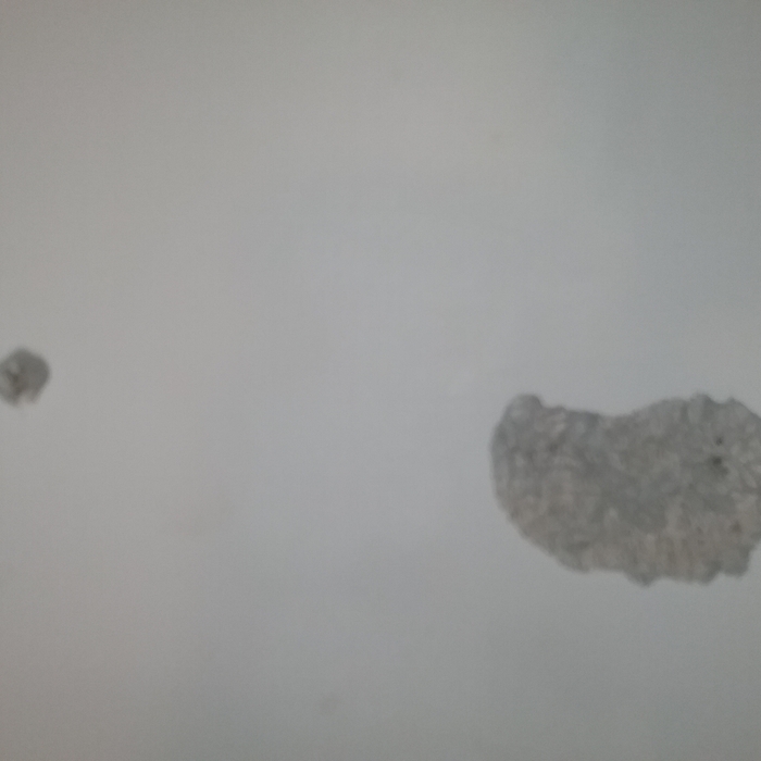 Before/After Photos