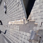Shingles