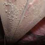 White Mold in crawl space