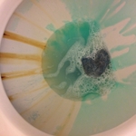 Toilet Before Cleaning