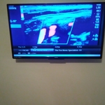 Tv mount