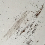 Bedbug Nest