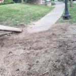 Large Removal After