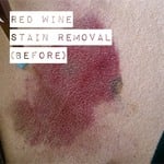 Wine Stain Removal (Before)