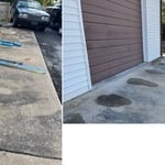 Before and after front view