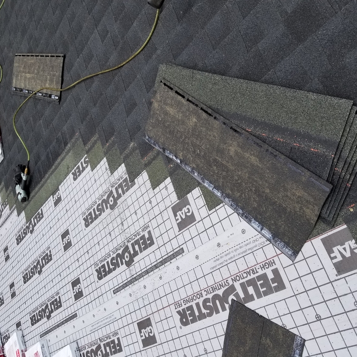 Shingles
