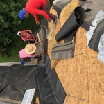 Shingles