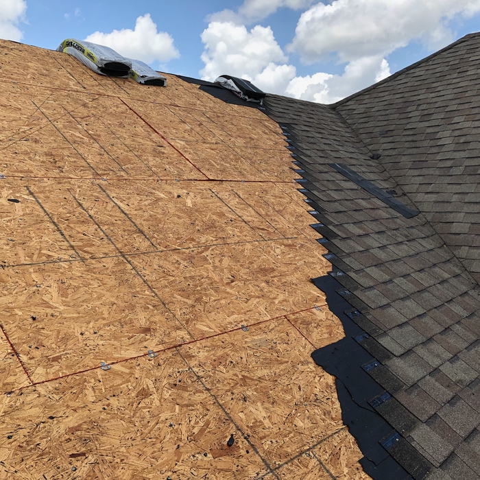 Shingles