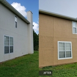 Before and After Pics