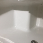 Before & After Cleanings